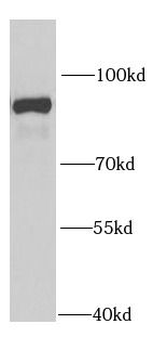 PTPRE Rabbit Polyclonal Antibody