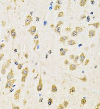 PTPRE Rabbit Polyclonal Antibody