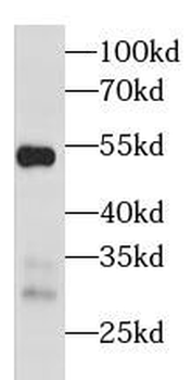 NR1I2 Antibody