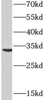 PYCR2 Antibody