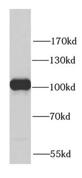 PYGB Antibody