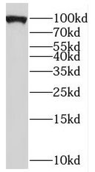 PYGB Antibody