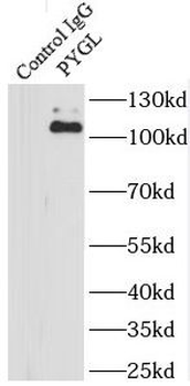 PYGL Rabbit Polyclonal Antibody