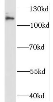 PTK2B Rabbit Polyclonal Antibody
