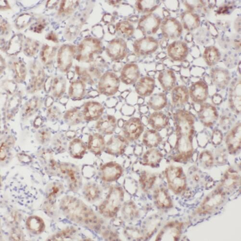 PTK2B Rabbit Polyclonal Antibody