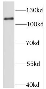 PTK2B Rabbit Polyclonal Antibody