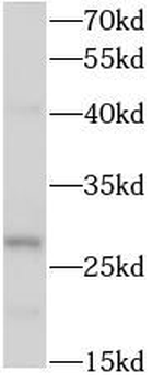 RAB12 Antibody