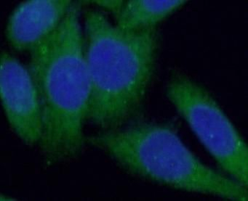 RAB12 Rabbit Polyclonal Antibody