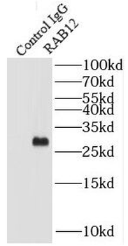 RAB12 Rabbit Polyclonal Antibody