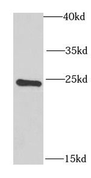 RAB17 Antibody