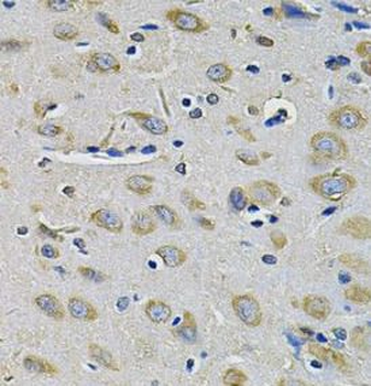 RAB17 Rabbit Polyclonal Antibody