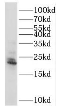 RAB18 Antibody
