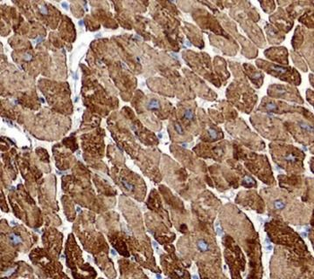 RAB1B Rabbit Polyclonal Antibody