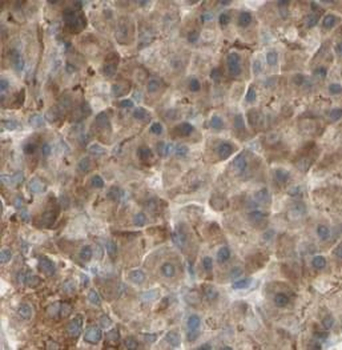 RAB27B Rabbit Polyclonal Antibody