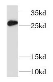 RAB33A Antibody
