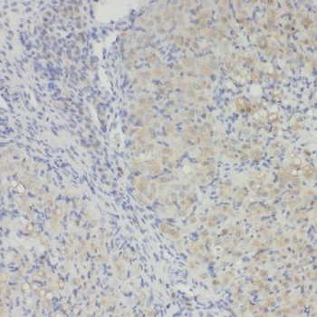 RAB34 Rabbit Polyclonal Antibody