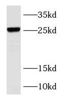 RAB37 Rabbit Polyclonal Antibody