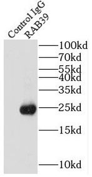 RAB39A Rabbit Polyclonal Antibody