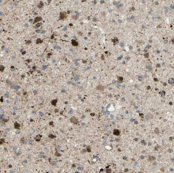 RAB39A Rabbit Polyclonal Antibody