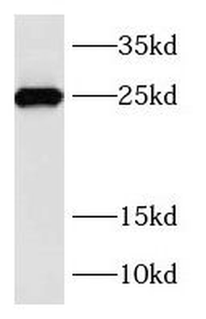 RAB39B Antibody