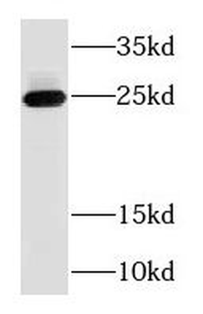 RAB3B Antibody