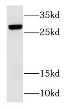 RAB3C Antibody