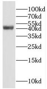 RAB3IL1 Antibody