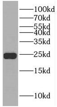 RAB6B Antibody