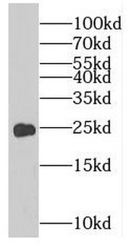RAB8B Antibody