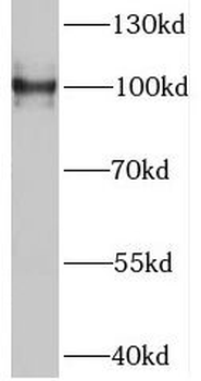RABEP1 Antibody