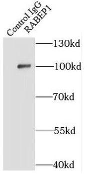 RABEP1 Rabbit Polyclonal Antibody