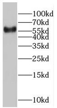 RABEP2 Rabbit Polyclonal Antibody