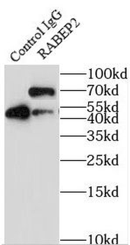 RABEP2 Rabbit Polyclonal Antibody