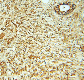 RABEP2 Rabbit Polyclonal Antibody