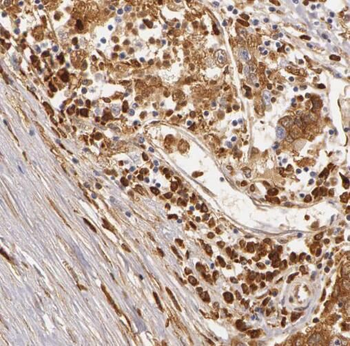 RABGAP1L Rabbit Polyclonal Antibody