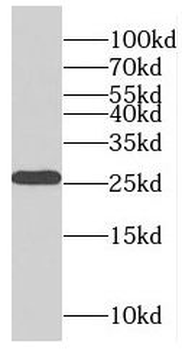 RABL2B Rabbit Polyclonal Antibody