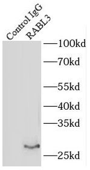 RABL3 Rabbit Polyclonal Antibody