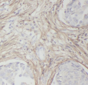 RABL3 Rabbit Polyclonal Antibody