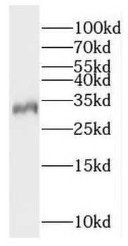 RAD1 Rabbit Polyclonal Antibody