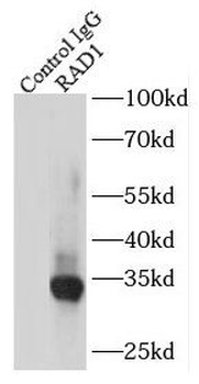 RAD1 Rabbit Polyclonal Antibody
