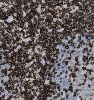 RAD1 Rabbit Polyclonal Antibody