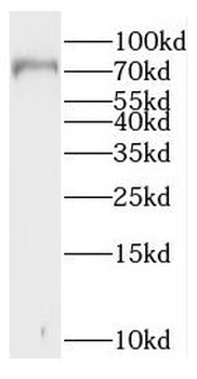 RAD17 Rabbit Polyclonal Antibody