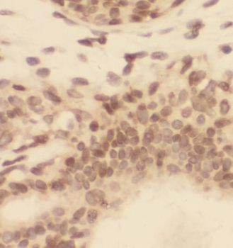 RAD17 Rabbit Polyclonal Antibody