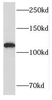 RADIL Antibody