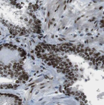 RAF1 Rabbit Polyclonal Antibody