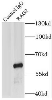 RAG2 Rabbit Polyclonal Antibody