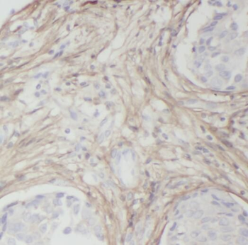 RAMP2 Rabbit Polyclonal Antibody