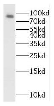 RANBP9 Antibody
