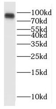 RANBP9 Rabbit Polyclonal Antibody