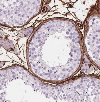 RANBP9 Rabbit Polyclonal Antibody
